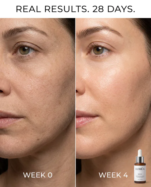 KI-generiertes Social Ad: Before-After-Vergleich Hautbild Woche 0 vs. Woche 4